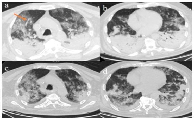 Hugging Face pmc clinical VQA raw