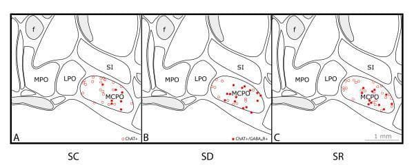 This Comparison Chart consists of three schematic neuroanatomical diagrams (A, B, C) illustrating the distribution of cholinergic neurons in the basal forebrain across three experimental conditions: Sleep Control (SC), Sleep Deprivation (SD), and Sleep Recovery (SR). The diagrams show coronal sections of the basal forebrain with specific anatomical regions labeled, including the fornix (f), medial preoptic area (MPO), lateral preoptic area (LPO), magnocellular preoptic area (MCPO), and substantia innominata (SI).
The primary focus is the MCPO, where ChAT+ cells are plotted. Open circles represent cells positive only for choline acetyltransferase (ChAT+), while filled red circles represent double-labeled cells expressing both ChAT and the beta 2-3 subunits of the GABA-A receptor (ChAT+/GABAAR+).
Comparison across conditions reveals a distinct shift in protein expression:
- SC (Panel A) shows a low proportion of double-labeled cells.
- SD (Panel B) demonstrates the highest prevalence of ChAT+/GABAAR+ double-labeled cells.
- SR (Panel C) shows an intermediate density.
This visual data illustrates the dynamic regulation of GABA receptors on cholinergic neurons in response to sleep homeostatic pressure, highlighting a key pathophysiological mechanism of sleep-wake regulation.