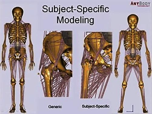 This Comparison Chart illustrates musculoskeletal modeling from the AnyBody simulation system, highlighting the differences between 'Generic' and 'Subject-Specific' anatomical representations. The central focus is a comparison of the hip region. The 'Generic' model depicts a standardized hip joint with simplified muscle fiber paths, shown as thin purple lines connecting the pelvis and femur. In contrast, the 'Subject-Specific' model features more complex and dense muscle fiber arrangements, reflecting individualized anatomy and biomechanical detail. On the far left and right, full-body musculoskeletal diagrams display the human skeletal frame—including the skull, thoracic cage, vertebral column, and appendicular skeleton—overlaid with an integrated muscular network. This visual material is used in biomechanics and physical therapy for kinematic analysis and gait simulation, specifically for studying joint reaction forces in the hip, knee, and ankle. The diagram serves as an educational tool for understanding musculoskeletal modeling and its clinical application in orthopedic research and personalized medicine.