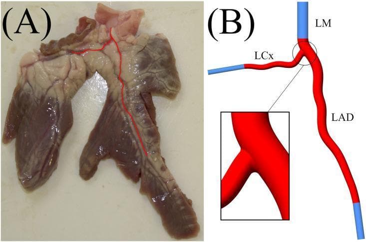This educational graphic consists of two panels focusing on coronary artery anatomy and computational modeling. Panel (A) is a clinical photograph of a porcine ex vivo heart segment, illustrating the epicardial surface. The coronary artery geometry is highlighted with a red overlay, showing the vessel's origin, descent, and bifurcation into major branches across the cardiac tissue. Panel (B) presents a corresponding anatomical diagram and 3D reconstruction model of a human-scaled coronary artery bifurcation. It labels the Left Main (LM) coronary artery as the inlet, branching into the Left Anterior Descending (LAD) and the Left Circumflex (LCx) arteries. The diagram uses blue segments to represent computational domain extensions (inlets and outlets) and red to indicate the physiological vessel geometry. A magnified inset provides a detailed view of the bifurcation carina and the smooth transition between the parent vessel and daughter branches. This material is designed to demonstrate the translation of ex vivo anatomical findings into idealized geometries for hemodynamic and cardiovascular research.