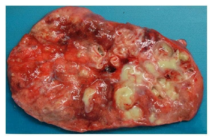 Hugging Face pmc clinical VQA raw