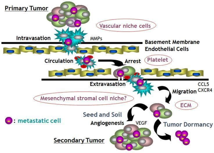 A pathophysiology diagram illustrating the invasion-metastasis cascade in cancer biology. The process begins at the top with a 'Primary Tumor' containing heterogeneous cells, including specific 'metastatic cells' (marked with purple nuclei). The cascade proceeds through 'Intravasation,' where tumor cells penetrate the 'Basement Membrane' and 'Endothelial Cells' facilitated by Matrix Metalloproteinases (MMPs) and vascular niche cells. Within the 'Circulation' phase, metastatic cells interact with 'Platelets' to form clusters before reaching 'Arrest' at a distant site. This is followed by 'Extravasation,' where cells exit the vasculature and undergo 'Migration' into the 'Mesenchymal stromal cell niche,' influenced by the extracellular matrix (ECM) and chemokines like CCL5 and CXCR4. The final stages include 'Seed and Soil Angiogenesis' driven by Vascular Endothelial Growth Factor (VEGF), which can lead to either 'Tumor Dormancy' or the successful colonization and formation of a 'Secondary Tumor.' The diagram effectively summarizes the sequential cellular interactions and molecular signaling involved in malignant progression.