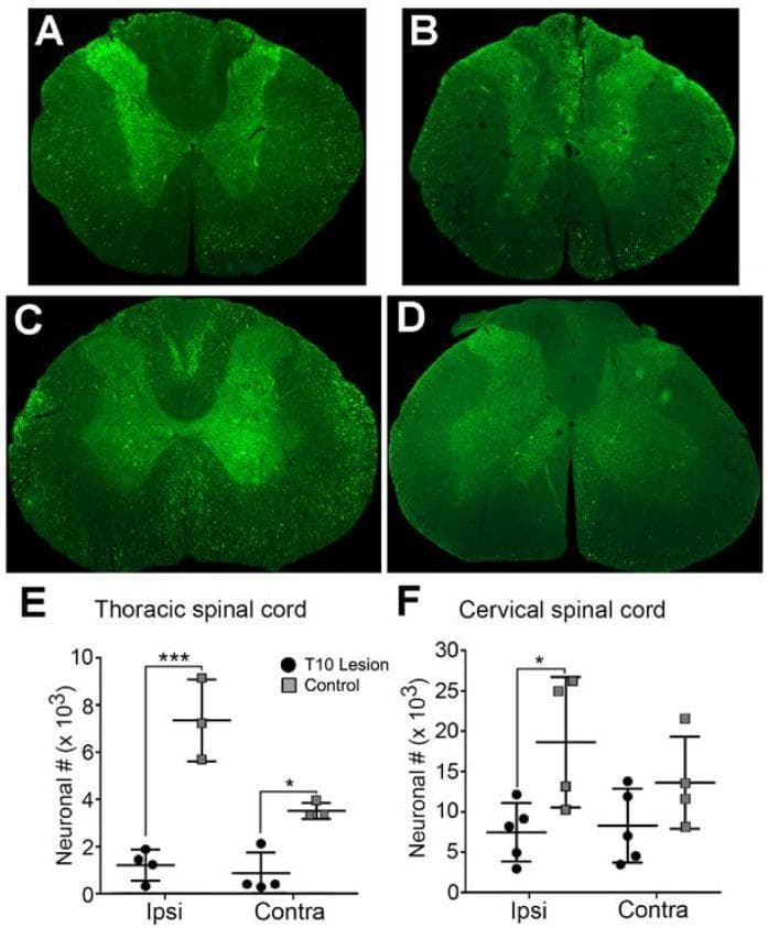 This composite educational graphic illustrates the histological and quantitative impact of a T10 spinal cord contusion injury on neuronal populations using a rat model. Panels A-D display fluorescence microscopy images of transverse spinal cord sections. Panels A and C show normal spinal cords (T7 and C4 levels respectively) with widespread, high-intensity Green Fluorescent Protein (GFP) expression within neurons and axons across gray and white matter, indicating robust axonal transport from a lumbar injection site. Panels B and D demonstrate the same regions post-T10 contusion, revealing a marked reduction in GFP-labeled structures, signifying interrupted retrograde transport and axonal degeneration. Panels E and F provide quantitative analysis via scatter plots comparing neuronal counts in 'T10 Lesion' vs. 'Control' groups. The thoracic region (E) shows a significant decrease in neuronal numbers on both ipsilateral and contralateral sides post-injury. The cervical region (F) shows a more localized significant decrease on the ipsilateral side. This visual comparison demonstrates the pathophysiology of spinal cord injury and its effect on long-distance neural connectivity and propriospinal neuronal survival.