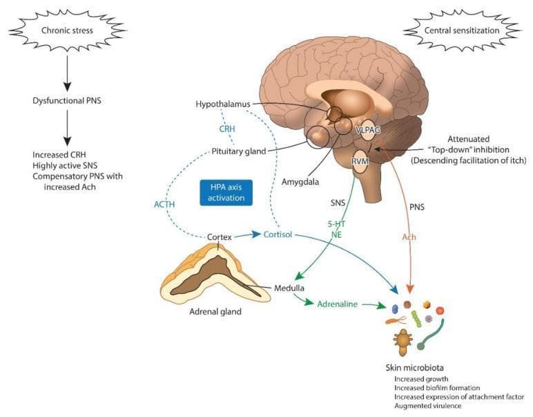 This pathophysiology diagram illustrates the bidirectional communication between the brain and skin microbiota under chronic stress, focusing on the hypothalamic-pituitary-adrenal (HPA) axis and the 'top-down' modulation of itch. The visual depicts a sagittal view of the human brain highlighting the Hypothalamus, Pituitary Gland, Amygdala, Ventrolateral Periaqueductal Grey (VLPAG), and Rostral Ventromedial Medulla (RVM). A flowchart links chronic stress to HPA axis activation, showing CRH, ACTH, and Cortisol signaling. Cortisol is shown directly influencing skin microbiota and the amygdala, contributing to central sensitization. The diagram features a 'Descending facilitation of itch' pathway where attenuated top-down inhibition involves the VLPAG and RVM. Neurochemical mediators including Serotonin (5-HT), Norepinephrine (NE), and Acetylcholine (Ach) from the Sympathetic (SNS) and Parasympathetic (PNS) nervous systems are shown modulating the skin microbiota. Educational outcomes noted include increased microbial growth, biofilm formation, and augmented virulence in response to these hormonal and neural cues, illustrating the concept of the skin-brain axis in dermatological conditions like chronic itch.