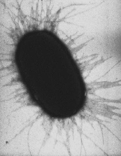 High-magnification diagnostic micrograph, likely electron microscopy, capturing a single Escherichia coli (E. coli) bacterium. The image features a prominent, dark, electron-dense central body with a characteristic rod-shaped (bacillus) morphology. Radiating outward from the entire cellular periphery are numerous thin, hair-like filamentous structures identified as fimbriae or pili. These proteinaceous appendages appear as fine, somewhat irregular threads that vary in linearity, showing some overlapping and branching patterns as they extend into the surrounding medium. The educational focus is on bacterial ultrastructure and virulence factors, specifically demonstrating the physical presence of adhesive filaments that facilitate bacterial attachment to host surfaces and biofilm formation. This visual is highly relevant to microbiology, infectious disease pathology, and the study of bacterial mechanobiology in clinical settings.