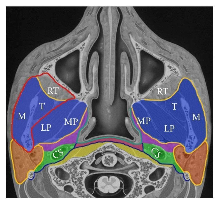 Hugging Face pmc clinical VQA raw