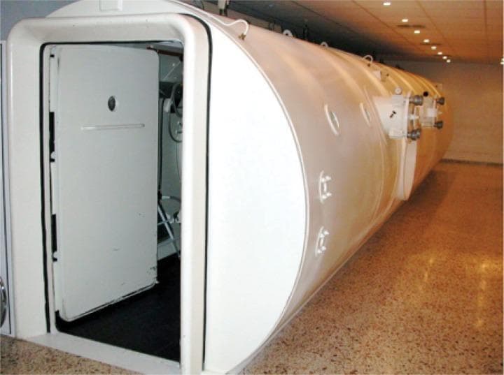 A clinical photograph of a multiplace hyperbaric oxygen chamber (HBOT), showcasing its external structure in a hospital setting. The chamber is a large, white, horizontally oriented cylinder constructed from 12mm thick steel. The image displays the entrance with a heavy-duty, hinged pressure door swung inward, featuring a small circular viewing porthole and a horizontal locking handle. Along the lateral side of the vessel, several small, circular methacrylate windows are visible, which serve for patient observation and wireless signal transmission. External hardware, including pressure-rated valves and bolted circular port interfaces, are mounted on the steel hull. The chamber is designed to accommodate multiple patients simultaneously, allowing for the delivery of pure oxygen at pressures higher than atmospheric levels. This specialized medical device is used for treating conditions such as decompression sickness, carbon monoxide poisoning, and non-healing diabetic wounds. The floor consists of clinical-grade tiling, and the chamber occupies a dedicated therapeutic bay.