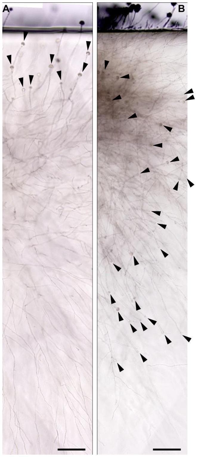 This diagnostic microbiological image demonstrates the oxygen-dependent development of Aspergillus fumigatus conidiophores within a gel-embedded substrate. The image is a comparative study using the sandwiched culture method on glucose minimal agar (GMM) media after 72 hours of incubation. Panel A illustrates fungal colonies grown in ambient air, showing that conidiophores (indicated by black arrowheads) are primarily restricted to the upper agar layer near the agar-air interface. Panel B depicts colonies grown in oxygen-saturated agar, revealing a significantly higher density of conidiophores distributed throughout the colony matrix, including deeper layers. The visual components include translucent vegetative hyphae and distinct, developing conidiophores characterized by stalks and vesicles. In Panel B, these structures appear more developed and abundant, suggesting that oxygen concentration serves as both a prerequisite and a directional cue for conidiogenesis in an embedded environment. Scale bars represent 100 µm. This material is pedagogically relevant for medical mycology and microbiology, illustrating the environmental regulation of fungal morphology and reproductive differentiation.