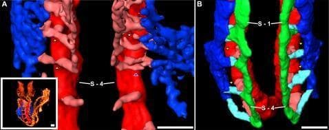 This comparative pathophysiology diagram utilizes 3D surface-rendered imaging to demonstrate the development and remodeling of occipital intersomitic vessels in an embryo. Panel A (8-somite stage) illustrates the early vascular network where the dorsal aorta (DA, red) gives rise to intersegmental arteries (ISA, pink). A transient arteriovenous shunt (AVS), indicated by yellow arrowheads, directly connects the DA to the early cardinal vein (ECV, blue). A white arrowhead marks a regressing ISA at the level of somite S-4. Panel B (15-somite stage) shows the progression after the AVS has regressed (yellow arrowheads). The persistent vasculature includes the vertebral artery (VTA, green), which connects the dorsal ISAs. These are linked via light blue intersomitic vessels (ISVs) to the anterior cardinal vein (ACV) or common cardinal vein (CCV, blue). The somites S-1 and S-4 serve as anatomical landmarks. This visualization highlights the complex transition from transient embryonic shunts to a stable circulatory pattern in the occipital region, providing an educational model for vascular embryology and morphogenesis.
