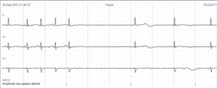 Hugging Face pmc clinical VQA raw