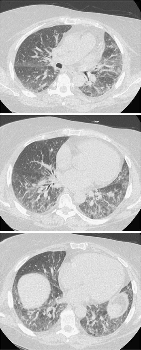 Hugging Face pmc clinical VQA raw