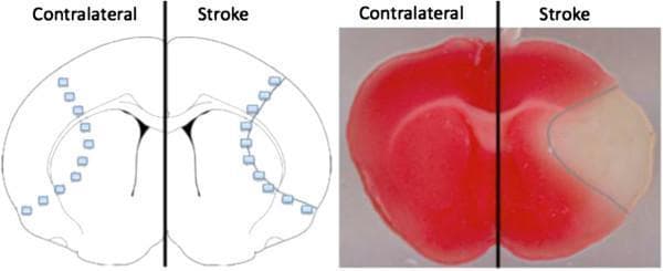 This composite image illustrates the demarcation of ischemic brain injury in a murine model following middle cerebral artery occlusion (MCAO). On the right is a diagnostic pathology photograph of a coronal brain section stained with 2,3,5-triphenyltetrazolium chloride (TTC). The contralateral (left) hemisphere appears uniformly deep red, indicating viable tissue with active mitochondrial dehydrogenase enzymes. The stroke (right) hemisphere reveals a stark, pale-white region corresponding to the necrotic stroke core where metabolic activity has ceased. Surrounding this core is a thin, intermediate pink rim delineated by a blue line, representing the ischemic penumbra—a region of at-risk but salvageable tissue. On the left, a corresponding anatomical diagram provides a schematic for tissue collection protocols. Small blue squares indicate the standardized sampling sites within the cortex, demonstrating how tissue is harvested from both the penumbra (along the blue border) and the infarcted core for comparative biochemical analysis. This image is used in neurobiology to study stroke pathophysiology and neuroprotective interventions.
