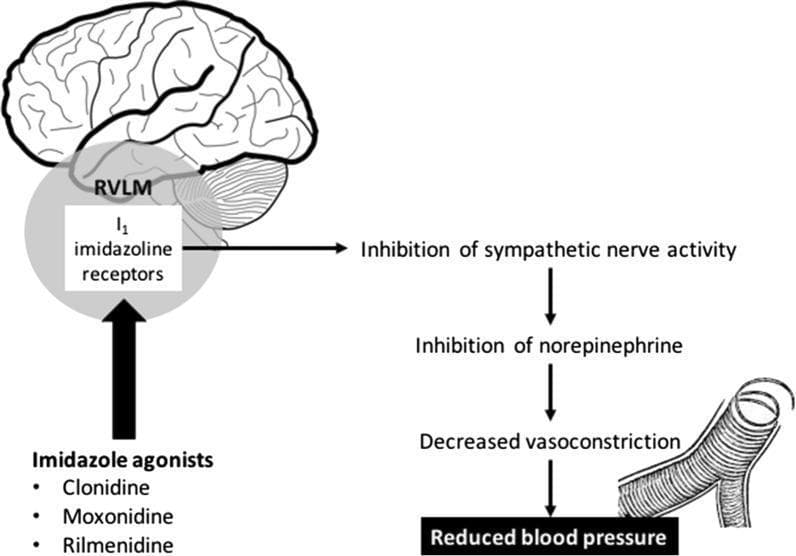 This pathophysiology diagram illustrates the mechanism of action of imidazoline receptor agonists on blood pressure regulation. The visual is divided into a sagittal brain anatomical diagram and a secondary physiological flowchart. On the left, the diagram highlights the 'I1 imidazoline receptors' located within the Rostral Ventrolateral Medulla (RVLM) of the brainstem, situated inferior to the cerebrum and anterior to the cerebellum. Below this, three pharmacological agents—Clonidine, Moxonidine, and Rilmenidine—are listed as imidazole agonists that target these receptors. To the right, a downward flowchart depicts the systemic consequences of receptor activation: stimulation of the RVLM leads to the 'Inhibition of sympathetic nerve activity,' followed by the 'Inhibition of norepinephrine' release. This progression results in 'Decreased vasoconstriction,' visually represented by an illustration of a dilated blood vessel with reduced smooth muscle tension. The final clinical outcome is identified as 'Reduced blood pressure.' The content is designed for intermediate medical education, focusing on neuropharmacology and cardiovascular physiology.