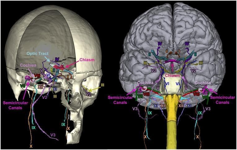 A 3D anatomical reconstruction showcasing the segmentation and spatial orientation of the 12 pairs of human cranial nerves (CN I–XII). The image presents two views: a lateral perspective within a partially transparent skull (left) and an anterior-inferior view relative to the brain and brainstem (right). Each nerve is color-coded for identification: CN I (Olfactory), CN II (Optic) with the optic chiasm and tract, CN III (Oculomotor), CN IV (Trochlear), CN V (Trigeminal) including V2 (maxillary) and V3 (mandibular) divisions, CN VI (Abducens), CN VII (Facial), CN VIII (Vestibulocochlear), CN IX (Glossopharyngeal), CN X (Vagus), CN XI (Accessory), and CN XII (Hypoglossal). Key inner ear structures, including the snail-shaped cochlea and the loop-like semicircular canals, are visualized in relation to the facial and vestibulocochlear nerves. This diagnostic-quality illustration demonstrates the complex neuroanatomical pathways through the skull base and their origins at the brainstem, serving as a pedagogical tool for neurology, radiology, and neurosurgery training.