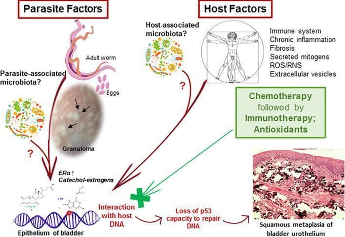 A pathophysiology diagram and clinical imaging composite illustrating the carcinogenesis pathway of urogenital schistosomiasis-induced bladder cancer. The visual is divided into 'Parasite Factors' and 'Host Factors'. Parasite factors include an illustration of an adult Schistosoma worm, pink oval eggs, a parasite-associated microbiota, and a clinical photograph of a granuloma with internal calcifications (indicated by black arrows). Host factors list immune system status, chronic inflammation, fibrosis, ROS/RNS, and host-associated microbiota. The central mechanism depicts parasite-derived catechol estrogens and mitogens interacting with host DNA within the bladder epithelium. This leads to the 'loss of p53 capacity to repair DNA', eventually progressing to the 'Squamous metaplasia of bladder urothelium', shown in a bottom-right histopathology image. The histopathology displays typical features of metaplastic transformation with a dense, pink-stained keratinized surface and irregular cellular infiltration. A green box highlights therapeutic interventions including chemotherapy, immunotherapy, and antioxidants, symbolized by a green cross blocking the DNA-interaction pathway.