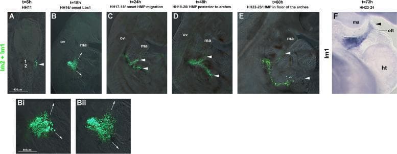 This composite diagnostic and pathophysiology diagram illustrates the migration of occipital lateral mesoderm in a developing avian embryo using GFP electroporation and in situ hybridization. Panels A through E display a temporal sequence from HH11 (t=6h) to HH22-23 (t=60h). Fluorescent GFP-labeled cells, initially localized near somites 1 and 2 (lm1+lm2), are shown organizing into two distinct migratory streams: a rostral stream projecting toward the pharyngeal arches and a lateral-caudal stream. Higher magnification panels (Bi, Bii) at HH16 highlight the onset of this bifurcation. Panel F shows GFP mRNA expression (blue staining) at HH23-24, demonstrating the accumulation of these lateral mesoderm-derived cells near the mandibular arch (ma) and the heart's outflow tract (oft). Anatomical landmarks include the otic vesicle (ov), heart (ht), and mandibular arch. This content serves as an educational resource for embryology and developmental biology, specifically regarding circumpharyngeal cell movements and the origins of cranial and cardiac mesodermal structures.