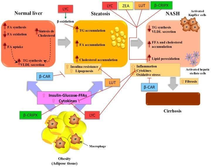 A pathophysiology diagram illustrating the progression of Non-Alcoholic Fatty Liver Disease (NAFLD) and the protective mechanisms of dietary carotenoids. The flow depicts the transition from a 'Normal Liver' to 'Steatosis' (characterized by triglyceride, fatty acid, and cholesterol accumulation), then to 'NASH' (Non-Alcoholic Steatohepatitis, marked by lipid peroxidation, activated Kupffer cells, and hepatic stellate cells), and finally to 'Cirrhosis' with advanced fibrosis. The diagram maps the systemic influence of obesity and adipose tissue, which contribute to increased insulin, glucose, free fatty acids (FFAs), and cytokines. Specific carotenoids are shown as therapeutic modulators: Lycopene (LYC) promotes beta-oxidation and inhibits inflammation; beta-carotene (beta-CAR) inhibits insulin resistance and the transition to cirrhosis; and Lutein (LUT), Zeaxanthin (ZEA), and beta-cryptoxanthin (beta-CRIPX) act as inhibitors of disease progression pathways between steatosis and NASH. Green arrows indicate promotion/increase, while red T-bars indicate inhibition or blocking of pathological pathways, emphasizing the antioxidant and anti-inflammatory roles of these nutrients in preventing hepatocyte damage and fibrosis.