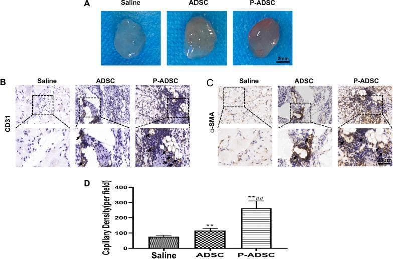 A multi-panel figure illustrating the results of a Matrigel plug assay investigating angiogenesis. Panel A shows macroscopic clinical photographs of harvested Matrigel plugs from three groups: Saline (clear/translucent), ADSC (adipose-derived stem cells, slightly opaque), and P-ADSC (platelet extracellular vesicle-preconditioned ADSCs, noticeably reddish/pink). Panels B and C present immunohistochemical (IHC) staining of plug sections for CD31 (endothelial marker) and alpha-smooth muscle actin (alpha-SMA, pericyte/mature vessel marker), respectively. The P-ADSC group exhibits the highest density of brown chromogen staining, indicating increased vessel formation. Each IHC panel includes high-magnification insets highlighting specific vascular structures. Panel D provides a quantitative bar graph of capillary density per field, statistically demonstrating that P-ADSCs significantly enhance angiogenesis compared to saline (**p < 0.01) and standard ADSCs (##p < 0.01). This content demonstrates the proangiogenic potential of preconditioned stem cells in regenerative medicine applications.