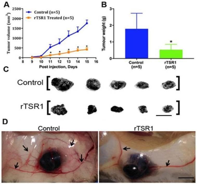 This composite image illustrates the results of an oncology study investigating the efficacy of rTSR1 treatment on B16F10 melanoma tumor growth in a mouse model. Panel A displays a tumor growth curve over 15 days, showing a significant reduction in tumor volume (mm³) in the rTSR1-treated group compared to the control group. Panel B presents a bar graph of mean tumor weight at day 15, quantifying the substantial decrease in mass with treatment. Panel C provides a macro photograph of five dissected dark, pigmented tumor nodules from each group, visually confirming the size reduction in the rTSR1 row; scale bar 1 cm. Panel D shows clinical photographs of the peri-tumor environment in situ. The control group image features dense, robust, and complex vascular branching (indicated by arrows) surrounding the tumor. In contrast, the rTSR1-treated tumor shows a markedly reduced vascular network with fewer and thinner vessels, illustrating the anti-angiogenic properties of the TSR1 domain of ADAMTS5. This image is relevant for studying cancer therapeutics, specifically angiogenesis inhibitors and their impact on tumor proliferation.