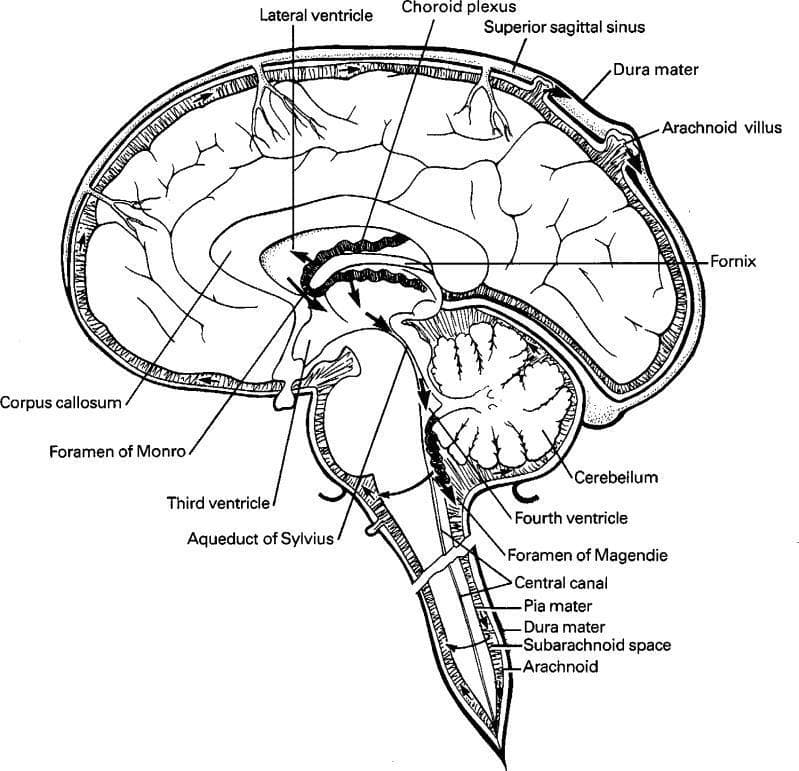 This medical anatomical diagram illustrates the production, circulation, and resorption of cerebrospinal fluid (CSF) within the human central nervous system. The illustration is a sagittal cross-section of the brain and upper spinal cord, highlighting the ventricular system and meningeal layers. Key anatomical structures labeled include the lateral ventricle, choroid plexus (the primary site of CSF production), the Foramen of Monro, third ventricle, Aqueduct of Sylvius, and fourth ventricle. The pathway of CSF flow is indicated by directional arrows, tracing the fluid's movement from the ventricles through the Foramen of Magendie into the subarachnoid space and the central canal. The diagram also depicts the three meningeal layers: the outermost dura mater, the arachnoid mater, and the innermost pia mater, with the subarachnoid space clearly delineated between the arachnoid and pia. Educational focus is placed on CSF resorption via the arachnoid villi (granulations) into the superior sagittal sinus. Supporting landmarks such as the corpus callosum, fornix, and cerebellum provide spatial context for neuroanatomical study.