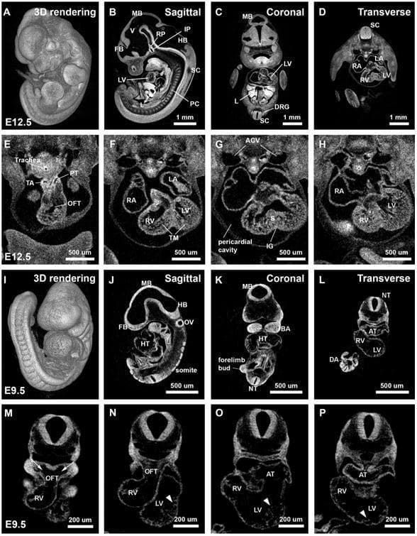 This composite diagnostic image features high-resolution 2D virtual sections and 3D reconstructions of mouse embryos at developmental stages E12.5 (A–H) and E9.5 (I–P), obtained via iodine-contrast micro-computed tomography (microCT). Panels A–D and I–L provide comparative 3D renderings and orthogonal sections (sagittal, coronal, and transverse) of the whole embryos. Key neurological structures labeled include the forebrain (FB), midbrain (MB), hindbrain (HB), ventricles (V), and neural tube (NT). In E12.5 sections, advanced organogenesis is visible, including the liver (L), primordial cartilage of vertebrae (PC), and dorsal root ganglion (DRG). High-magnification transverse cardiac views (E–H and M–P) illustrate the progression of heart development. At E12.5, the heart exhibits clear septation with distinct right and left atria (RA/LA) and ventricles (RV/LV), along with the trabeculated myocardium (TM), interventricular septum (S), thoracic aorta (TA), and pulmonary trunk (PT). Conversely, E9.5 images depict earlier stages featuring a primitive heart tube (HT), common atrium (AT), and early trabeculae formation (arrowheads). These images serve as an educational resource for embryology and high-resolution developmental imaging.