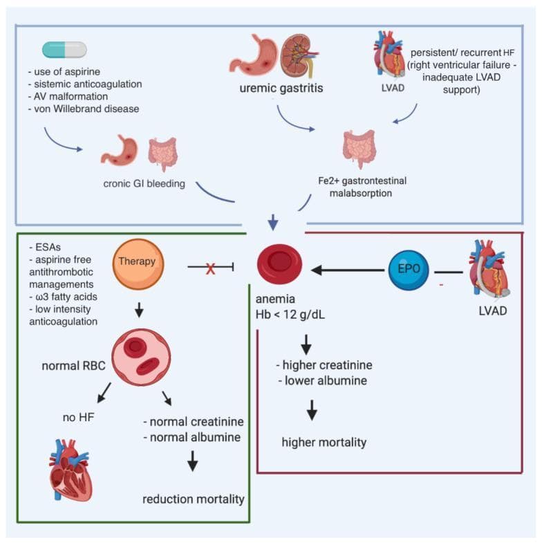 This pathophysiology diagram illustrates the multifactorial causes and consequences of anemia in patients with heart failure (HF) and a left ventricular assist device (LVAD). The top section identifies contributors to anemia, including chronic gastrointestinal (GI) bleeding secondary to aspirin use, systemic anticoagulation, arteriovenous (AV) malformations, and von Willebrand disease. Other contributing factors shown are uremic gastritis, iron (Fe2+) malabsorption, and persistent right ventricular failure. Central to the diagram is the manifestation of anemia (defined as Hemoglobin < 12 g/dL), which correlates with elevated creatinine, decreased albumin, and increased mortality. The diagram also highlights therapeutic interventions such as erythropoiesis-stimulating agents (ESAs), aspirin-free antithrombotic management, omega-3 fatty acids, and low-intensity anticoagulation. Successful therapy is depicted as leading to normal red blood cell (RBC) counts, resolution of heart failure symptoms, and reduced mortality. The role of erythropoietin (EPO) is also noted in the context of LVAD-related anemia management.