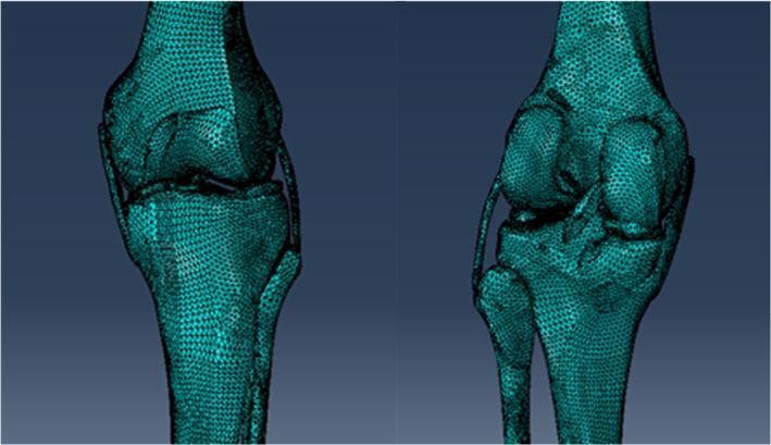 This diagnostic illustration presents two perspective views of a three-dimensional (3D) native human knee joint model. The visualization is a finite element or triangulated mesh representation derived from fused CT and MRI data. Anatomical structures shown include the distal femur, proximal tibia, and proximal fibula, with the mesh density clearly defining the cortical surfaces and contours. The model highlights soft tissue integration, specifically depicting the meniscus and the four major stabilizing ligaments: the anterior cruciate ligament (ACL), posterior cruciate ligament (PCL), medial collateral ligament (MCL), and lateral collateral ligament (LCL). The spatial relationships illustrate the tibiofemoral and proximal tibiofibular articulations. This digital model serves as a foundation for biomechanical simulations, such as Unicompartmental Knee Arthroplasty (UKA) planning and stress distribution analysis. The anatomical accuracy is tailored for orthopedic research and surgical education, emphasizing joint kinematics and structural integrity.
