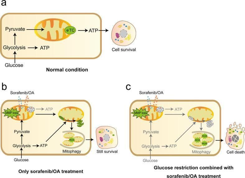 This pathophysiology diagram illustrates the metabolic mechanisms and survival outcomes of hepatocellular carcinoma (HCC) cells under three different experimental conditions.
Panel A (Normal condition) shows healthy cellular metabolism where glucose enters the cell, undergoing glycolysis to produce ATP and pyruvate. Pyruvate enters the mitochondria, powering the electron transport chain (eTC) for further ATP generation, resulting in cell survival.
Panel B (Only sorafenib/OA treatment) depicts the effect of electron transport chain inhibitors (sorafenib or oligomycin/antimycin). This treatment causes mitochondrial membrane potential (MMP) loss and impairs mitochondrial ATP production. However, glycolysis remains active, generating sufficient ATP to support PINK1-mediated mitophagy. Mitophagy eliminates damaged mitochondria and prevents reactive oxygen species (ROS) accumulation, allowing continued cell survival.
Panel C (Glucose restriction combined with sorafenib/OA treatment) demonstrates the synergistic effect of inhibiting both energy pathways. Glucose restriction abolishes glycolysis-derived ATP, which in turn prevents the activation of mitophagy despite mitochondrial damage. This leads to excessive ROS accumulation, extensive mitochondrial failure, and clinical cell death. This diagram highlights the importance of targeting dual metabolic pathways in HCC therapy.