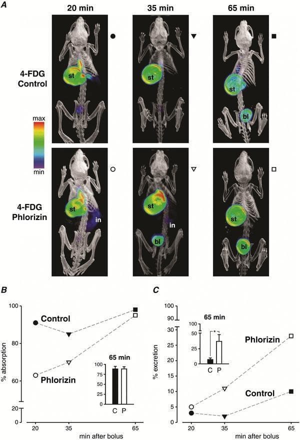 This diagnostic image set illustrates the pharmacokinetics and biodistribution of 4-FDG (4-fluorodeoxyglucose) in a mouse model using PET-CT imaging. Panel A displays volumetric renderings of whole-body PET-CT scans at 20, 35, and 65 minutes post-oral gavage. The top row (Control) shows high tracer intensity primarily in the stomach (st) at early time points, with minimal excretion. The bottom row (Phlorizin-treated) demonstrates the effect of SGLT1/SGLT2 inhibition, characterized by visible tracer in the intestine (in) and significantly earlier and higher accumulation in the urinary bladder (bl). An NIH color scale indicates activity intensity from red (highest) to purple (lowest). Panel B provides a quantitative comparison of gastrointestinal absorption over time, showing a significant initial delay in the phlorizin group at 20 and 35 minutes, which converges by 65 minutes. Panel C quantifies renal excretion, highlighting that phlorizin treatment leads to a marked increase in the percentage of the tracer excreted into the bladder (reaching ~35% at 65 min) compared to control (~7%). These visuals demonstrate the role of SGLTs in intestinal glucose absorption and renal reabsorption.