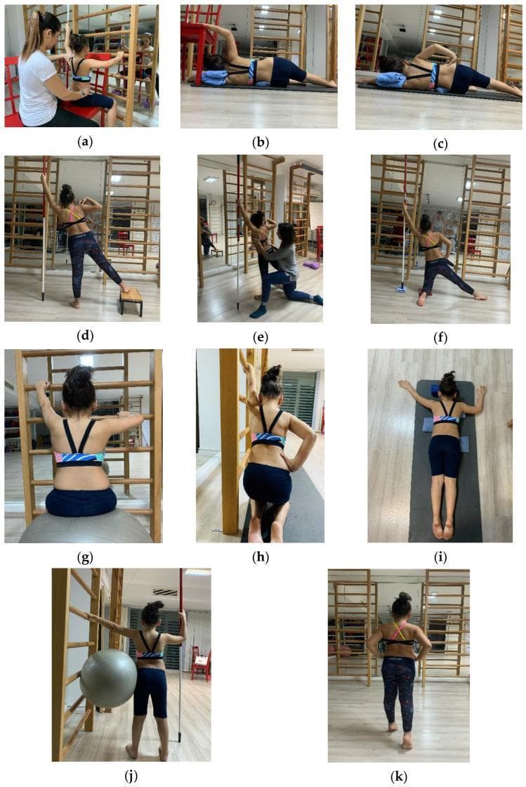 A series of clinical photographs (a-k) documenting a patient performing the Schroth method, a conservative physiotherapeutic scoliosis-specific exercise (PSSE) system. The images demonstrate three-dimensional postural corrections using specific therapeutic equipment. (a-f, h) utilize Swedish wall bars and poles for elongation and shoulder counter-traction. (b, c, i) show side-lying and prone positions on mats with supportive cushions for muscle cylinder and rotational respiration training. (g, j) demonstrate sitting and standing exercises using a Swiss ball to challenge core stability and pelvic alignment. Key anatomical focuses visible include the correction of thoracic and lumbar spinal asymmetry, pelvic tilt adjustment, and paraspinal muscle engagement. These exercises aim to treat idiopathic scoliosis by promoting spinal elongation, derotation, and lateral correction through specialized breathing and isometric tension techniques. The series illustrates the clinical application of Schroth principles including rotational respiration, sail exercises, sideways hangs, and gait training in a rehabilitative setting.