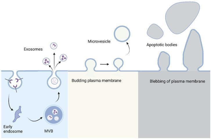 This pathophysiology diagram illustrates the biogenesis and release mechanisms of three major types of extracellular vesicles (EVs): exosomes, microvesicles, and apoptotic bodies. The diagram is divided into three sections from left to right. The first section shows the endosomal pathway for exosome formation, beginning with plasma membrane invagination to form an early endosome, which matures into a multivesicular body (MVB) containing intraluminal vesicles; these are released as exosomes via exocytosis when the MVB fuses with the cell surface. The second section depicts the formation of microvesicles through the direct outward budding and pinching off of the plasma membrane. The third section illustrates the formation of apoptotic bodies, which are larger, irregularly shaped remnants resulting from the extensive blebbing and fragmentation of the plasma membrane during programmed cell death (apoptosis). The illustration highlights key morphological differences in size and origin, identifying exosomes as the smallest vesicles derived from internal compartments, microvesicles as intermediate-sized surface buds, and apoptotic bodies as the largest, heterogeneous fragments of a dying cell.