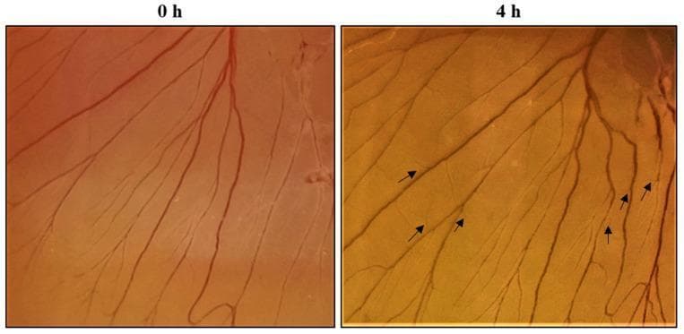 This clinical photograph displays a side-by-side comparison of an in vivo Chorioallantoic Membrane (CAM) assay used to evaluate the angiogenic potential of a SPEM (sericin and decellularized extracellular matrix) scaffold. The left image (0 h) represents the baseline vascular network, showing established reddish-brown blood vessels branching across the transparent membrane. The right image (4 h) illustrates the progression of angiogenesis after a four-hour treatment period. In this frame, black arrows highlight the rapid formation of new, finer capillary sprouts and secondary branching from the pre-existing vessels. The comparison demonstrates the scaffold's ability to stimulate neovascularization, a critical component of the proliferative phase of wound healing. This experimental model is highly relevant to regenerative medicine and the development of bioactive wound dressings that utilize growth factors to promote tissue regeneration and nutrient supply through enhanced blood vessel formation.