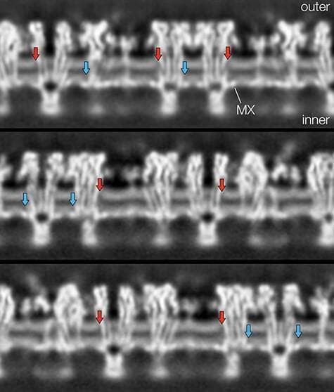 This diagnostic visualization presents cross-sections through a helical reconstruction of a cholinergic postsynaptic membrane, likely derived from cryo-electron microscopy. The image displays the profile of a lipid bilayer at the neuromuscular junction, characterized by two parallel tracks of high-intensity light grey densities representing phospholipid headgroups. The total thickness between these headgroup peaks is approximately 30 ร
. Interspersed within this lipid matrix are irregular blocks of density representing nicotinic acetylcholine receptor proteins, including transmembrane (TM) helices and cytoplasmic MX helices. Red arrows highlight localized gaps or weakening of density in the outer leaflet adjacent to protein surfaces, while blue arrows indicate similar regions of weakened density in the inner leaflet above the MX helices. These specific visual gaps are attributed to high concentrations of cholesterol, which lacks a large electron-dense headgroup compared to phospholipids. The arrangement illustrates the non-uniform distribution of cholesterol and its role in forming protein-stabilized microdomains within the postsynaptic membrane.