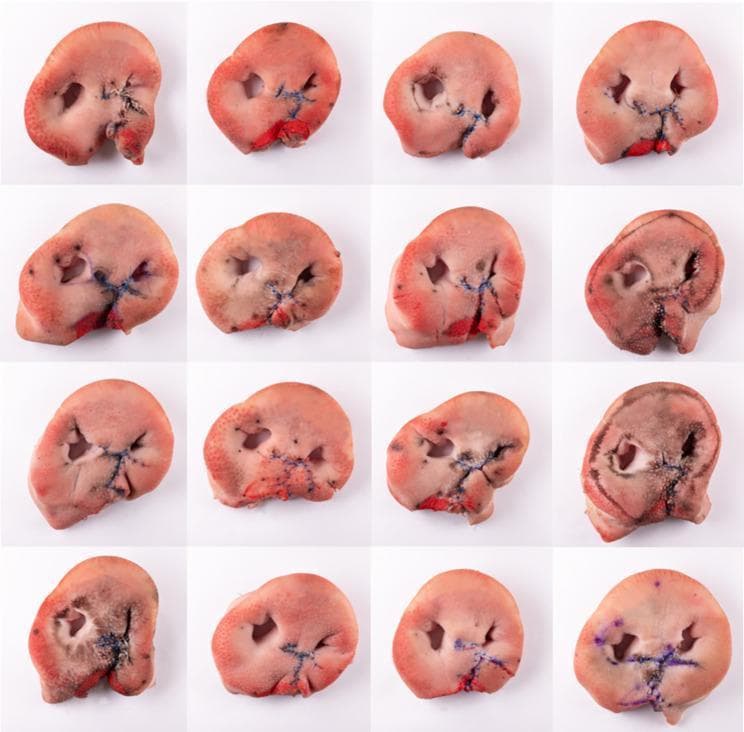A comparison chart containing a 4x4 grid of 16 clinical specimen photographs. The images depict ex vivo porcine snout discs used as anatomical models for surgical simulation of unilateral cleft lip repair. Each specimen shows a porcine snout that has been modified to simulate a cleft lip, followed by surgical closure using the Millard II rotation-advancement technique. Key visible features include the dual nostril openings, the pinkish integument of the snout, and dark, non-absorbable sutures used to approximate the surgical incisions. Red markings indicate the reconstructed vermillion border. The collection demonstrates a variety of surgical outcomes, illustrating differences in suture tension, stitch intervals, tissue alignment, and the final contour of the reconstructed philtrum and lip. This material serves as a pedagogical resource in maxillofacial and plastic surgery for training residents in cheiloplasty techniques and evaluating the consistency of tissue approximation and aesthetic outcomes in a bench-model setting.