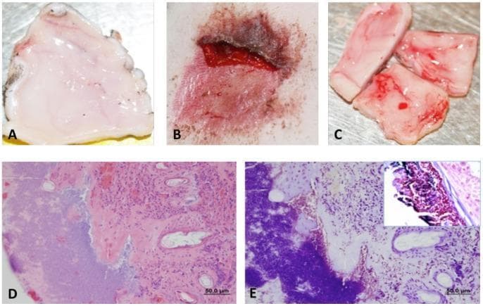 This composite image provides a comparative study of Staphylococcus aureus infection in an abrasion model, utilizing clinical photographs and histopathology. Panels A-C show macroscopic views: A displays an uninfected abrasion control with smooth, uniform pinkish-white tissue; B demonstrates an S. aureus-infected lesion characterized by a dark brown-red scab, serous exudate, and significant inflammation; C illustrates the ventral side of the infected site with visible hypervascularization. Panels D and E show corresponding microscopic findings at 24 hours post-infection. Panel D is an H&E stained section (50.0 µm scale) showing dense infiltration of inflammatory cells within the dermis and disrupted tissue architecture. Panel E features a Gram stain revealing large, deep purple clusters of Gram-positive cocci embedded within the extracellular matrix, with a higher-magnification inset detailing the bacterial morphology. This sequence serves as an educational resource for identifying macroscopic signs of acute pyogenic infection and correlating them with the presence of bacteria and host immune response.