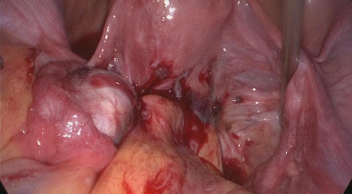 Hugging Face pmc clinical VQA raw