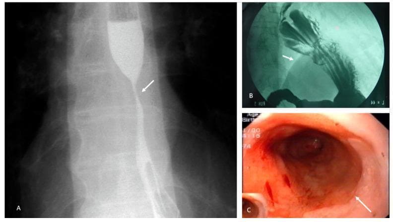 Hugging Face pmc clinical VQA raw