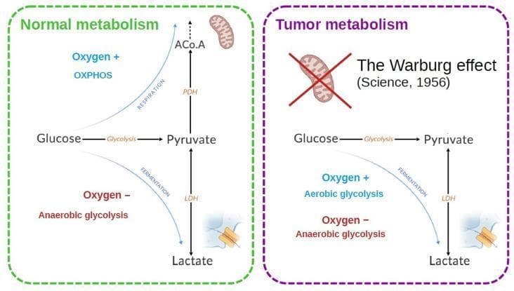 A pathophysiology diagram comparing cellular energy metabolism in normal versus tumor cells. The 'Normal metabolism' panel illustrates that glucose is converted to pyruvate via glycolysis. In the presence of oxygen (Oxygen + OXPHOS), pyruvate is converted to Acetyl-CoA (ACo.A) via Pyruvate Dehydrogenase (PDH) for mitochondrial respiration. In the absence of oxygen (Oxygen - Anaerobic glycolysis), pyruvate is converted to lactate via Lactate Dehydrogenase (LDH) through fermentation. In contrast, the 'Tumor metabolism' panel highlights the 'Warburg effect,' visually depicted by a red 'X' over the mitochondrion. Here, tumor cells predominantly utilize aerobic glycolysis even in the presence of oxygen, resulting in an increased flux from glucose to pyruvate and subsequently to lactate via fermentation. Key enzymes depicted include PDH and LDH, and a membrane-bound transporter (likely MCT) is shown facilitating lactate efflux. The diagram uses dashed borders (green for normal, purple for tumor) and specific color-coded text to differentiate between physiological respiration and pathological aerobic glycolysis.