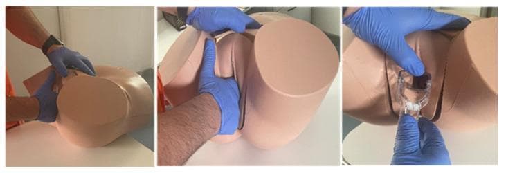 A series of three clinical photographs demonstrating the use of a Clinical Female Pelvic Trainer (CFPT) Mk 3 mannequin for gynaecological simulation. The mannequin is a skin-toned anatomical model representing the female lower torso and pelvic region in the lithotomy position, featuring realistic external genitalia including the labia majora and minora. The images illustrate standard steps of a gynaecological examination performed by an examiner wearing blue nitrile gloves. The first panel shows external palpation and inspection of the perineal area. The second panel demonstrates bimanual digital examination with the index and middle fingers inserted into the vaginal canal while the other hand stabilizes the pelvic model. The third panel shows the correct insertion technique of a clear plastic Graves or Cusco speculum into the vaginal opening to visualize the cervix. This visual material is intended for medical education to teach basic gynaecological skills, speculum placement, and bimanual palpation techniques.