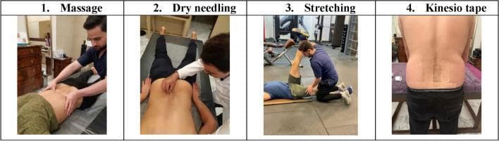 A four-panel clinical photograph montage illustrating therapeutic interventions for low back pain and musculoskeletal rehabilitation. Panel 1 (Massage) shows a practitioner applying manual therapy techniques, such as kneading or effleurage, to the lumbar paravertebral muscles of a patient in a prone position. Panel 2 (Dry Needling) depicts a clinical procedure where fine needles are inserted into myofascial trigger points along the lumbar spine and paraspinal tissues for neuromodulation. Panel 3 (Stretching) demonstrates a Proprioceptive Neuromuscular Facilitation (PNF) technique, with the therapist performing a passive straight leg raise to stretch the hamstring group while the patient is supine. Panel 4 (Kinesio Tape) shows the application of therapeutic elastic tape on the posterior trunk; two I-strips are placed vertically over the erector spinae muscles and two strips are placed horizontally/diagonally across the sacral region to provide sensory input and support. The series emphasizes multimodal physical therapy approaches in managing lumbar dysfunction.