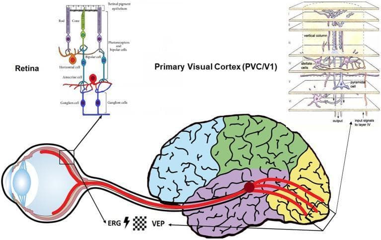 This medical schematic illustrates the visual pathway from the eye to the brain, highlighting the structural hierarchy of the retina and the primary visual cortex (PVC/V1). The diagram consists of three main parts: an anatomical overview and two detailed histological schematics. The anatomical overview shows the eye connected to the visual cortex via the optic nerve, labeled with electrophysiological markers ERG (Electroretinogram) and VEP (Visual Evoked Potential) alongside flash and checkerboard stimuli symbols. The retinal schematic details the vertical organization of the retinal pigment epithelium, photoreceptors (rods and cones), horizontal cells, bipolar cells, amacrine cells, and ganglion cells. The PVC/V1 schematic demonstrates the neocortical cytoarchitecture, organized into layers I through VI. It depicts key cell types including stellate cells in layer IV and pyramidal cells in layer V, organized into a vertical column. The diagram illustrates signal input specifically to layer IV and the subsequent output from deeper layers. This infographic serves as a comparative tool for understanding neuro-retinal continuity and the use of visual electrophysiology in diagnosing neurodegenerative and psychiatric disorders.