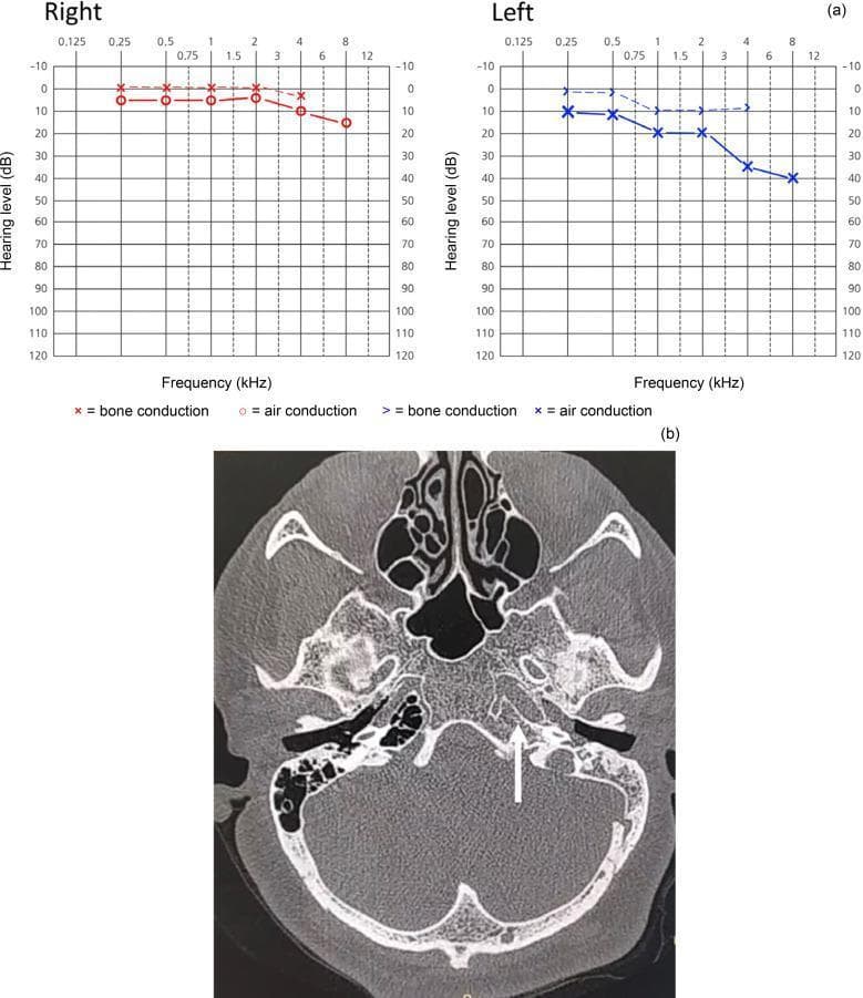 Hugging Face pmc clinical VQA raw