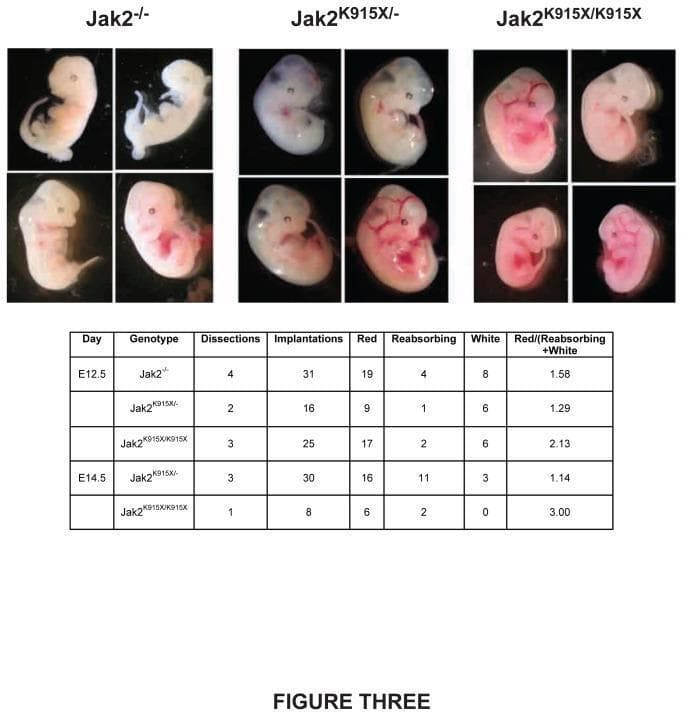 Educational medical graphic presenting a comparative analysis of embryonic development in mouse models with different Jak2 mutations. The upper portion contains clinical photographs of representative embryos at gestational stage E12.5, categorized by genotype: Jak2-/-, Jak2 K915X/-, and Jak2 K915X/K915X. The Jak2-/- embryos appear predominantly blanched and white, indicating severe anemia or impaired erythropoiesis. The Jak2 K915X/- group shows variable phenotypes from white to partially red, while the Jak2 K915X/K915X homozygous mutants appear notably redder, suggesting improved vascularization or red blood cell production. Below the photographs, a clinical data table summarizes quantitative findings from dissections at stages E12.5 and E14.5. The table lists genotypes against implantation counts and developmental outcomes, categorized as 'Red' (healthy), 'Reabsorbing' (terminal), or 'White' (anemic). This resource illustrates the impact of Jak2 mutations on fetal hematopoiesis and embryonic viability, demonstrating how specific mutations like K915X may modulate the lethal null phenotype.