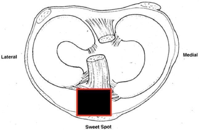 This medical anatomical diagram displays an axial cross-section of the human knee joint, focusing on the tibial plateau and its associated soft tissue structures. The illustration highlights the medial and lateral menisci as crescent-shaped fibrous structures resting on the articular surface. Centrally, the anterior and posterior cruciate ligaments are depicted, showing their relative spatial orientations. Soft tissue attachments, including the capsule and ligamentous fibers, are shown peripherally. A region labeled 'Sweet Spot' is highlighted with a red box at the anterior-inferior aspect of the joint space, corresponding to the clinical target for safe entry during suprapatellar tibial nailing (SPTN) procedures. This site is anatomically significant as the ideal starting point for intramedullary nail insertion, typically located on the medial aspect of the lateral tibial spine to minimize articular damage and optimize fracture reduction in proximal third tibial fractures. The diagram serves as an educational tool for orthopedic surgical planning and biomechanical understanding of the knee joint.