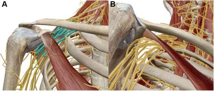 This medical anatomical diagram consists of two panels (A and B) illustrating the musculoskeletal and neural anatomy of the right infraclavicular thoracic outlet. Panel A provides an anterior view, highlighting the brachial plexus (teal) at the cord level as it passes through the retropectoralis minor space. The pectoralis minor muscle is shown originating from the third, fourth, and fifth ribs and inserting onto the coracoid process, forming a muscular bridge over the neurovascular structures. Panel B displays an outlet (inferior-to-superior) view, emphasizing the close spatial relationship between the undersurface of the pectoralis minor muscle and the underlying medial, lateral, and posterior cords of the brachial plexus. Key landmarks include the clavicle, ribs, coracoid process, and humerus. These illustrations serve to demonstrate the anatomical basis of pectoralis minor syndrome (PMS), an etiology of neurogenic thoracic outlet syndrome (NTOS) where hypertrophy or shortening of the muscle causes dynamic compression of the plexus cords against the posterior rib cage.