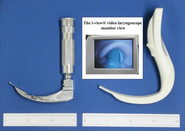 This comparative medical photograph displays two airway management devices: a conventional Macintosh laryngoscope (left) and an i-viewยฎ video laryngoscope (right), positioned above metric rulers for scale. The Macintosh laryngoscope features a classic metal construction with a cross-hatched cylindrical handle and a curved size-4 blade. In contrast, the i-viewยฎ video laryngoscope is an integrated single-piece device made of white plastic, characterized by a thicker, ergonomically shaped handle with a significant forward angulation and a longer curved blade. Centrally inset is a monitor view captured from the i-viewยฎ camera, illustrating a real-time laryngeal view during intubation. The digital display shows anatomical landmarks including the epiglottis and the opening to the glottis with the vocal cords visible under blue-tinted illumination. This comparison highlights structural differences in device geometry and material, which are critical educational factors in understanding maxillary incisor pressure and visualization success (Cormack-Lehane classification) during endotracheal intubation training in anesthesia and emergency medicine.