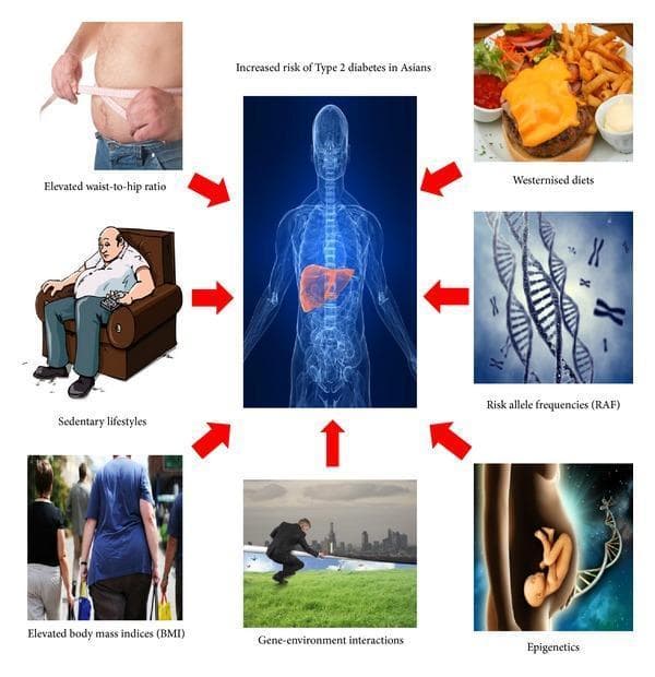 Educational infographic titled 'Increased risk of Type 2 diabetes in Asians' depicting a multifactorial model of disease pathogenesis. A central anatomical diagram of a human torso with a highlighted liver is surrounded by red arrows pointing to seven key contributing factors. The clinical and lifestyle factors include photographs and illustrations of: 'Elevated waist-to-hip ratio' (abdominal obesity measurement), 'Sedentary lifestyles' (physical inactivity), 'Elevated body mass indices (BMI)' (population overweight), and 'Westernised diets' (high-calorie processed food). The genetic and developmental components are represented by: 'Risk allele frequencies (RAF)' (DNA double-helix and chromosome imagery), 'Gene-environment interactions' (human interaction within a cityscape/natural setting), and 'Epigenetics' (maternal-fetal interaction with a DNA strand). This visual summarizes the synergy between genetic predisposition and environmental triggers in the development of insulin resistance and metabolic disease specifically within Asian populations.