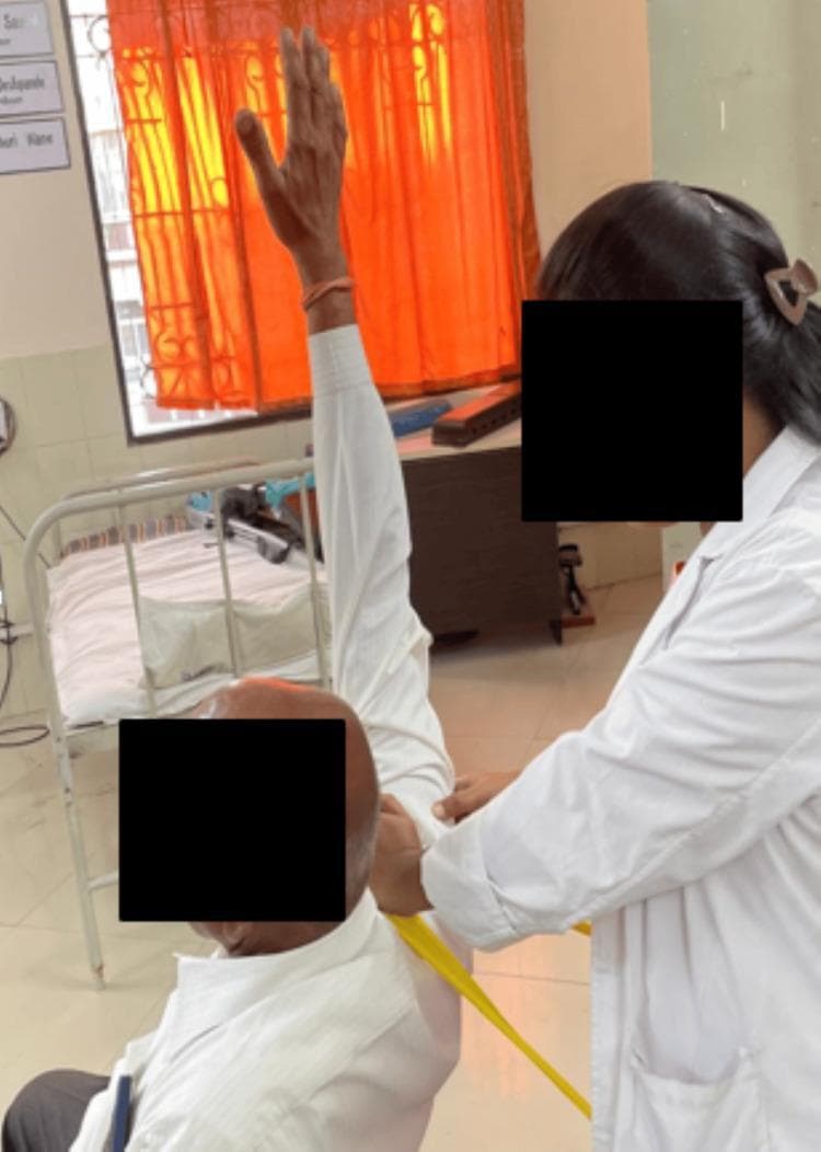 Clinical photograph illustrating a 'Mobilization with Movement' (MWM) technique for shoulder abduction in a patient with rotator cuff pathology. The image shows a healthcare professional in a white coat providing manual assistance to a patient's right shoulder. The patient's arm is elevated in a high degree of abduction. A yellow mobilization belt or resistance band is positioned around the proximal humerus to provide a sustained glide, likely lateral or inferior, aimed at improving joint arthrokinematics during active movement. The setting is a clinical rehabilitation environment, evidenced by a hospital bed with railings and medical signage in the background. This visual demonstrates a common physical therapy intervention used to increase range of motion and reduce pain in patients experiencing shoulder impingement or tendinopathy. The educational focus is on the manual application of orthopedic physical therapy techniques and the use of external aids to facilitate joint mobilization.