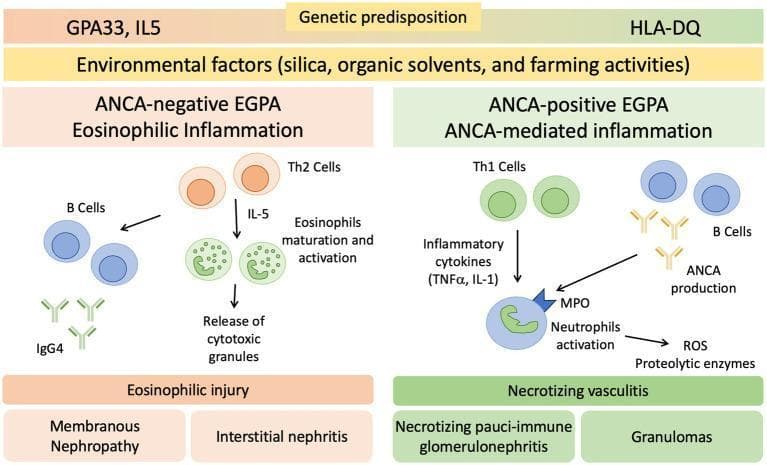 A medical pathophysiology diagram illustrating the dual-pathway pathogenesis of Eosinophilic Granulomatosis with Polyangiitis (EGPA) based on ANCA status. The diagram is divided into two primary sections: ANCA-negative EGPA (Eosinophilic Inflammation) and ANCA-positive EGPA (ANCA-mediated inflammation). Both pathways are preceded by genetic predispositions (GPA33, IL5 for ANCA-negative; HLA-DQ for ANCA-positive) and environmental triggers like silica and organic solvents. The ANCA-negative pathway shows Th2 cells secreting IL-5, leading to eosinophil maturation, activation, and release of cytotoxic granules, resulting in eosinophilic injury such as membranous nephropathy and interstitial nephritis; B cells contribute via IgG4 production. The ANCA-positive pathway depicts Th1 cells producing inflammatory cytokines (TNFα, IL-1) and B cells producing ANCA. These mediators activate neutrophils via myeloperoxidase (MPO), leading to reactive oxygen species (ROS) and proteolytic enzyme release. This results in necrotizing vasculitis, manifesting as necrotizing pauci-immune glomerulonephritis and granulomas.