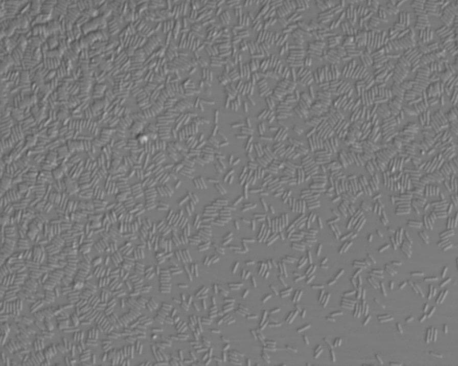 This diagnostic micrograph captures a significant bacterial contamination within an embryo culture medium during an in vitro fertilization (IVF) procedure. The image, likely obtained via phase-contrast or differential interference contrast (DIC) microscopy, shows a high-density proliferation of bacilli (rod-shaped bacteria) distributed throughout the liquid medium. The individual organisms exhibit a uniform, short-rod morphology with random orientation, suggesting rapid logarithmic growth. In several regions, the bacterial density is nearly confluent, creating a visually cluttered field against the hazy, grayish background of the culture environment. This visual evidence of contamination is clinically significant as it correlates with the degeneration of co-incubated oocytes, representing a major complication in assisted reproductive technology (ART). The image serves as an educational example of microbial iatrogenic contamination and its impact on embryological development and culture viability.